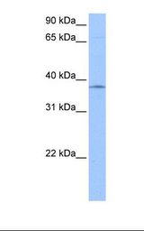 HepG2 cell lysate. Antibody concentration: 1.0 ug/ml. Gel concentration: 12%.