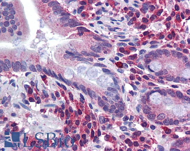 Anti-SPRY2 antibody IHC of human small intestine. Immunohistochemistry of formalin-fixed, paraffin-embedded tissue after heat-induced antigen retrieval. Antibody LS-B5819 concentration 5 ug/ml.