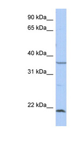 SPRY2 antibody LS-B5819 Western blot of THP-1 cell lysate.