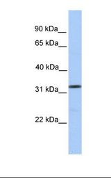 Fetal brain lysate. Antibody concentration: 1.0 ug/ml. Gel concentration: 12%.