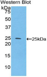 Western blot of recombinant SPRY3 / Sprouty 3.