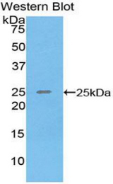 Western blot of recombinant SPRY3 / Sprouty 3.