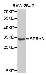 Western blot analysis of extracts of RAW264.7 cell lines, using SPRY3 antibody.