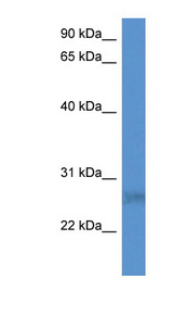 SPSB2 antibody LS-C135834 Western blot of HepG2 cell lysate.