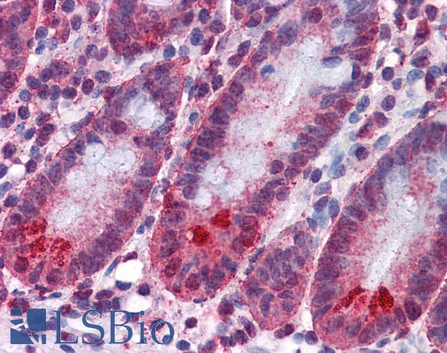 Anti-SPSB2 antibody IHC of human small intestine. Immunohistochemistry of formalin-fixed, paraffin-embedded tissue after heat-induced antigen retrieval. Antibody LS-B4541 concentration 5 ug/ml.