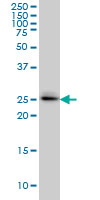 GRCC9 monoclonal antibody, clone 1E6 Western blot of SPSB2 expression in A-549.