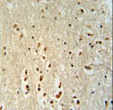 PTOV1 antibody immunohistochemistry of formalin-fixed and paraffin-embedded human brain tissue followed by peroxidase-conjugated secondary antibody and DAB staining.