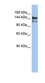 SUPT5H antibody LS-C101478 Western blot of Jurkat lysate.