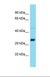 Western blot of Mouse Thymus. Supt7l antibody dilution 1.0 ug/ml.