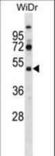 SUPT7L Antibody western blot of WiDr cell line lysates (35 ug/lane). The SUPT7L antibody detected the SUPT7L protein (arrow).