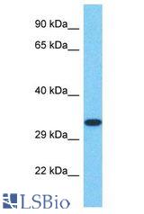 SPT7L / SUPT7L antibody Western Blot of HepG2. Antibody dilution: 1 ug/ml.