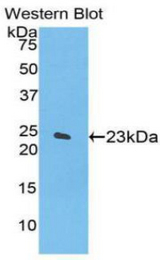 Western blot of recombinant SPTAN1 / Alpha Fodrin.