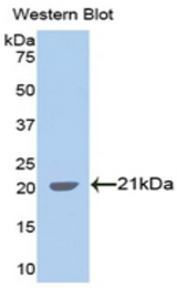 Western blot of recombinant SPTAN1 / Alpha Fodrin.