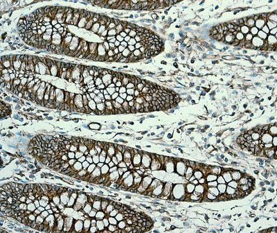 IHC of paraffin-embedded human colon tissue using anti-Alpha Fodrin antibody.