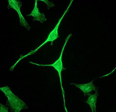 Immunofluorescent staining of HeLa cells using anti-Alpha Fodrin antibody.