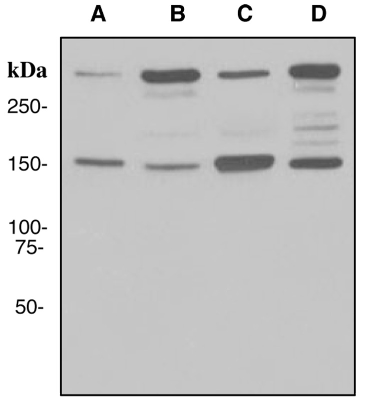 Western blot analysis on (A) HeLa + camptothecin, (B) HeLa, (C) Jurkat + staurosporine, and (D) Jurkat cell lysates using anti-Alpha Fodrin antibody.