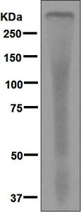 Western blot analysis on red blood cell lysate using anti-SPTB antibody.