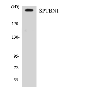 Western blot of the lysates from Jurkat cells using SPTBN1 antibody.