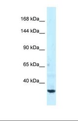 Western blot of Human NCI-H226. SPTBN1 antibody dilution 1.0 ug/ml.