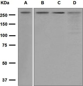 Western blot analysis on (A) SH-SY5Y, (B) HeLa, (C) Caco-2, and (D) Jurkat cell lysates using anti-Beta Fodrin antibody.