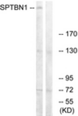 Western blot of extracts from COLO cells, using SPTBN1 Antibody. The lane on the right is treated with the synthesized peptide.