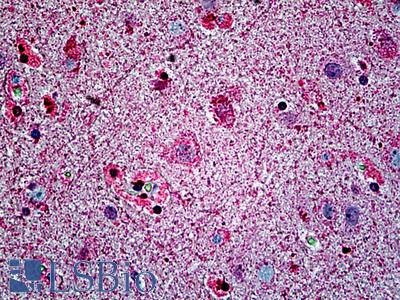 Anti-SPTBN4 antibody IHC of human brain, cortex. Immunohistochemistry of formalin-fixed, paraffin-embedded tissue after heat-induced antigen retrieval. Antibody LS-B5099 concentration 2.5 ug/ml.