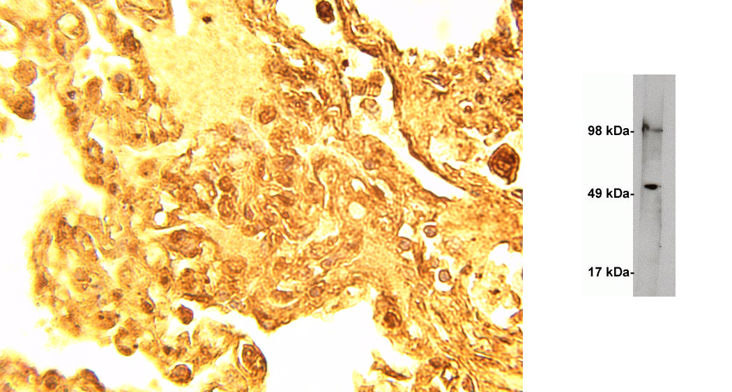 Left: IHC of normal human lung tissue with serine palmitoyltransferase 1 antibody (LS-C140566) at 15 ug/ml. Right: Western blot on human kidney lysate (10 ug/lane) using anti Serine palmitoyltransferase 1 antibody (LS-C140566) at 1 ug/ml. Blot was developed using anti rabbit HRP at 1:75k and Pierce Supersignal West Femto. Exposure was 2 minutes.