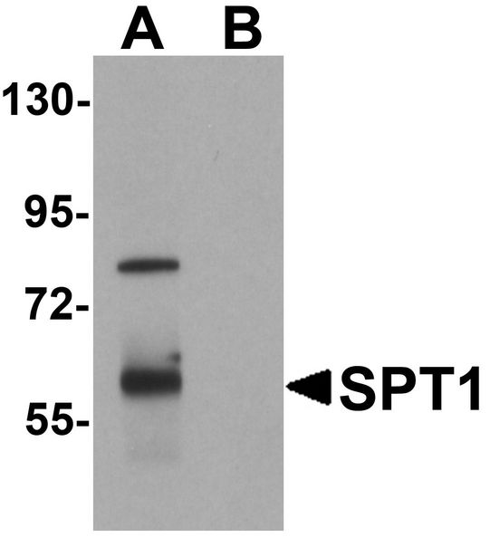 Western blot analysis of SPT1 in human lung tissue lysate with SPT1 antibody at 1 ug/ml in (A) the absence and (B) the presence of blocking peptide.