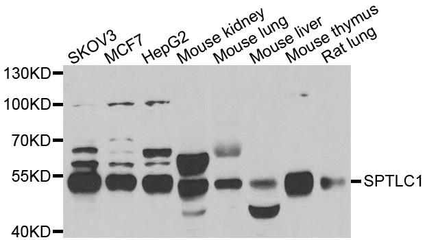 Western blot analysis of extracts of various cell lines, using SPTLC1 antibody.