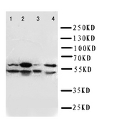 WB of SPTLC1 / HSN1 antibody. Lane 1: W620 Cell Lysate. Lane 2: S549 Cell Lysate. Lane 3: PANC Cell Lysate. Lane 4: U87 Cell Lysate.