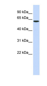 SPTLC1 antibody LS-C102242 Western blot of Fetal Brain lysate.