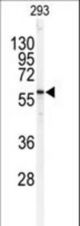 Western blot of anti-SPTLC1 Antibody in 293 cell line lysates (35 ug/lane). SPTLC1(arrow) was detected using the purified antibody.