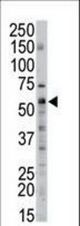 The anti-SPTLC2 antibody is used in Western blot to detect SPTLC2 in mouse liver tissue lysate.