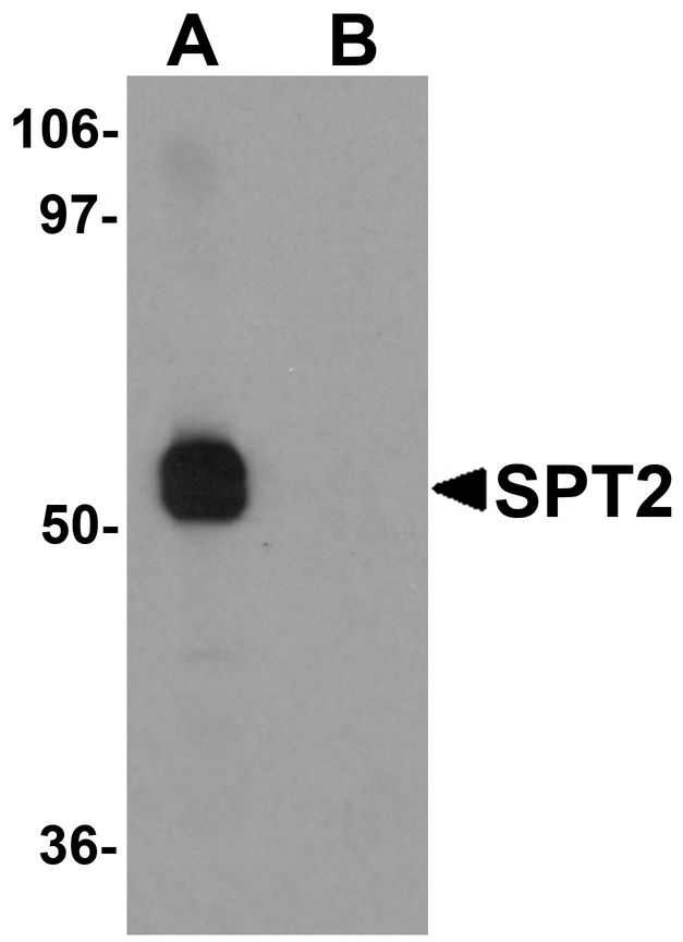 Western blot analysis of SPT2 in 3T3 cell lysate with SPT2 antibody at (A) 0.25 and (B) 0.5 ug/ml.