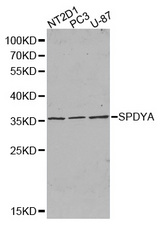 Western blot analysis of extracts of various cell lines, using SPDYA antibody.