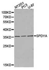 Western blot of extracts of various cell lines, using SPDYA antibody.