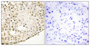 IHC of paraffin-embedded human testis tissue, using SPZ1 Antibody. The sample on the right was incubated with synthetic peptide.
