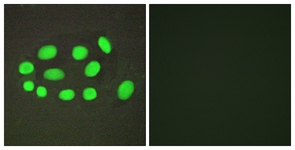 Immunofluorescence of A549 cells, using SPZ1 Antibody. The sample on the right was incubated with synthetic peptide.