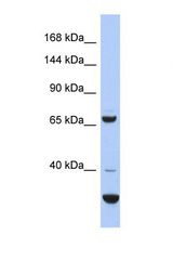 Western blot of Human COLO205. SRBD1 antibody dilution 1.0 ug/ml.
