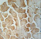 SRBD1 Antibody immunohistochemistry of formalin-fixed and paraffin-embedded human skeletal muscle followed by peroxidase-conjugated secondary antibody and DAB staining.