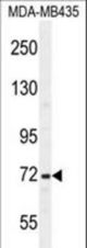 SRBD1 Antibody western blot of MDA-MB435 cell line lysates (35 ug/lane). The SRBD1 antibody detected the SRBD1 protein (arrow).