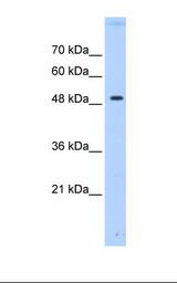 Transfected 293T cell lysate. Antibody concentration: 0.5 ug/ml. Gel concentration: 12%.