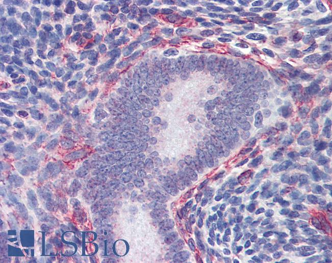 Anti-SRC antibody IHC of human uterus. Immunohistochemistry of formalin-fixed, paraffin-embedded tissue after heat-induced antigen retrieval. Antibody LS-B3308 concentration 5 ug/ml.