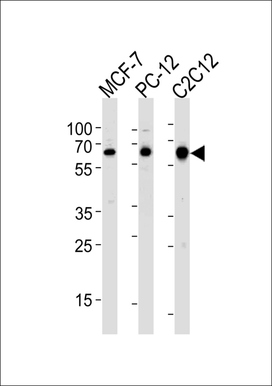 Western blot of lysates from MCF-7,rat PC-12,mouse C2C12 cell line (from left to right),using SRC Antibody (R14). Antibody was diluted at 1:1000 at each lane. A goat anti-rabbit IgG H&L (HRP) at 1:5000 dilution was used as the secondary antibody.Lysates at 35ug per lane.