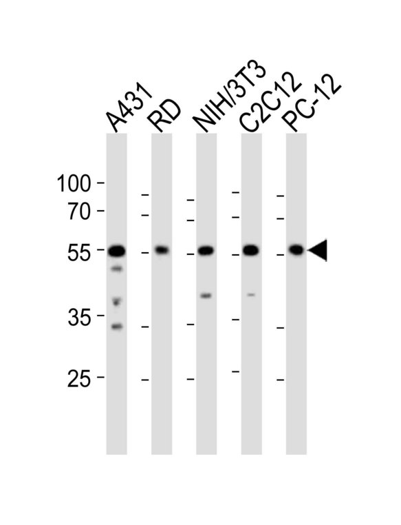 Western blot of lysates from A431, RD, mouse NIH/3T3, mouse C2C12, rat PC-12 cell line (from left to right), using SRC Antibody. Antibody was diluted at 1:1000 at each lane. A goat anti-rabbit IgG H&L (HRP) at 1:10000 dilution was used as the secondary antibody. Lysates at 20ug per lane.