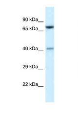 PRMT7 antibody LS-C145446 Western blot of Mouse Thymus lysate. Antibody concentration 1 ug/ml.