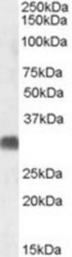 SRD5A2 antibody (1 ug/ml) staining of Human Testis lysate (35 ug protein/ml in RIPA buffer). Primary incubation was 1 hour. Detected by chemiluminescence.