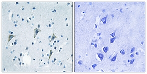 IHC of paraffin-embedded human brain tissue, using GPR85 Antibody. The sample on the right was incubated with synthetic peptide.