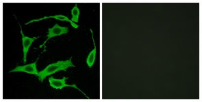 Immunofluorescence of LOVO cells, using GPR85 Antibody. The sample on the right was incubated with synthetic peptide.