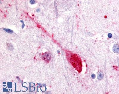 Anti-GPR85 antibody LS-A339 IHC of human putamen, neuron. Immunohistochemistry of formalin-fixed, paraffin-embedded tissue after heat-induced antigen retrieval.